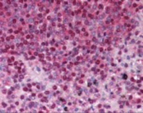 TNFRSF13B Antibody