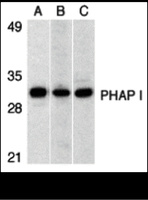 Anti-ANP32A Rabbit Polyclonal Antibody