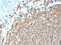 Anti-CD20 Mouse Monoclonal Antibody [clone: MS4A1/3411]