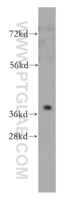 Anti-PTGR2 Rabbit Polyclonal Antibody