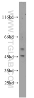 Anti-EYA2 Rabbit Polyclonal Antibody