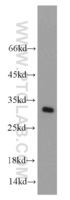 Anti-MRPS18B Rabbit Polyclonal Antibody