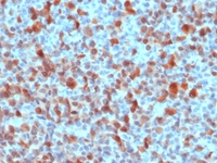 Anti-S100 beta Rabbit Polyclonal Antibody