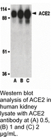 Anti-ACE2 Rabbit Polyclonal Antibody