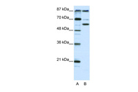 Anti-KAT2B Rabbit Polyclonal Antibody