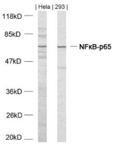NFkB p65 (Ab 468) Antibody
