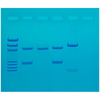 DNA Fingerprinting After PCR Amplification