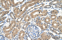 Anti-SLC16A8 Rabbit Polyclonal Antibody