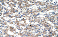 Anti-DUT Rabbit Polyclonal Antibody