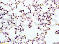 Anti-IL12RB2 Rabbit Polyclonal Antibody