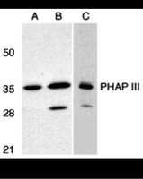 Anti-ANP32E Rabbit Polyclonal Antibody