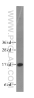 Anti-HMGN1 Rabbit Polyclonal Antibody