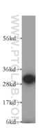 Anti-CAPZA1 Rabbit Polyclonal Antibody