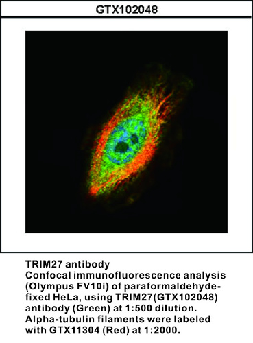 Rabbit Polyclonal antibody to TRIM27 (tripartite motif containing 27)