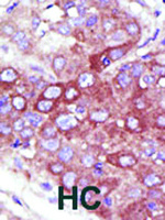 Anti-UBE2D1 Rabbit Polyclonal Antibody