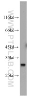 Anti-QDPR Rabbit Polyclonal Antibody
