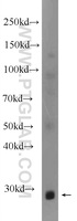 Anti-FTSJ2 Rabbit Polyclonal Antibody