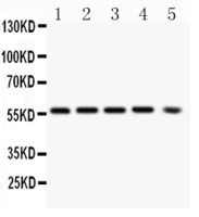 Anti-PKB alpha Mouse Monoclonal Antibody (KLH (Keyhole Limpet Hemocyanin)) [clone: IML-26]