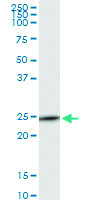 Anti-NMRK1 Polyclonal Antibody Pair