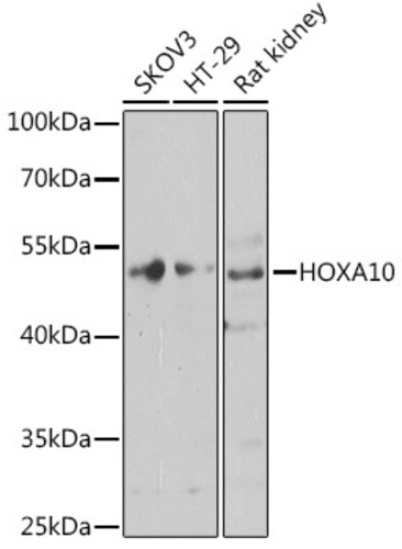 Anti-HOXA10 Rabbit Polyclonal Antibody