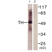 Anti-Tryptophan Hydroxylase Rabbit Polyclonal Antibody