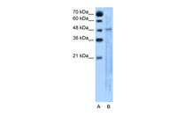 Anti-SLC25A46 Rabbit Polyclonal Antibody