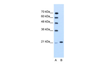 Anti-TRIM26 Rabbit Polyclonal Antibody