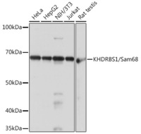 Anti-SAM68 Rabbit Monoclonal Antibody [clone: ARC0858]