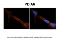 Anti-PDIA6 Rabbit Polyclonal Antibody