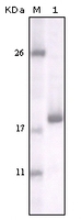 Anti-DDR2 Mouse Monoclonal Antibody [clone: 3B11E4]