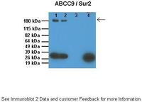Anti-ABCC9 Rabbit Polyclonal Antibody