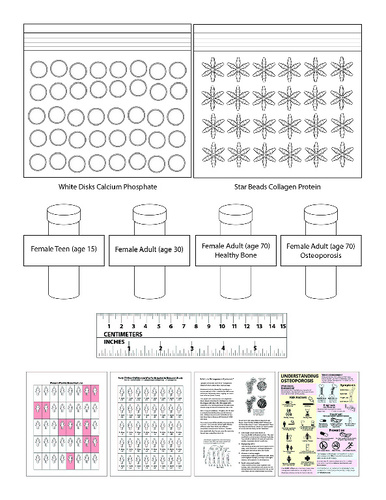 Science Take-Out® Brittle Bones: A Density Problem