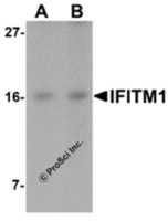 Anti-IFITM1 Rabbit Polyclonal Antibody