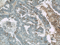 Anti-MUC16 Mouse Monoclonal Antibody [clone: 2B11B10]