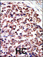 Anti-PRKD3 Rabbit Polyclonal Antibody