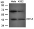 Western blot analysis of E2F-2 antibody in Hela and K562 cells lysate
