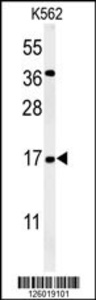 Anti-NAA50 Rabbit Polyclonal Antibody (Biotin)