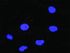 Anti-RPS6KA1 Antibody Pair