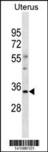 Anti-OR6S1 Rabbit Polyclonal Antibody (APC (Allophycocyanin))