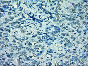 Anti-POR Mouse Monoclonal Antibody [clone: OTI5H5]