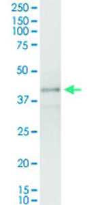 Anti-POU4F3 Polyclonal Antibody Pair