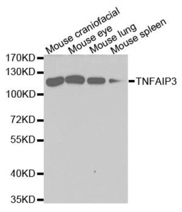 Western blot analysis of extracts of various cell lines using TNFAIP3 antibody