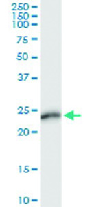 Anti-AMELX Polyclonal Antibody Pair