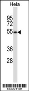 Anti-MAVS Rabbit Polyclonal Antibody (FITC (Fluorescein Isothiocyanate))