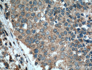 Anti-STIM1 Mouse Monoclonal Antibody [clone: 1D3A3]