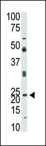 Anti-NEUROG1 Rabbit Polyclonal Antibody (AP (Alkaline Phosphatase))