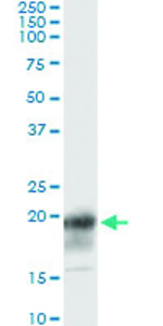 Anti-CD247 Antibody Pair
