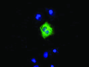 Anti-LIPG Mouse Monoclonal Antibody [clone: OTI7C2]