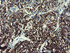 Anti-SLA2 Mouse Monoclonal Antibody [clone: OTI3A7]
