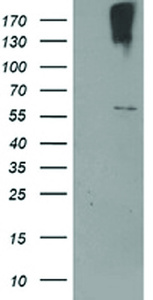 Anti-CYP2J2 Mouse Monoclonal Antibody [clone: OTI3A7]